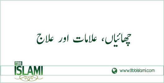 چھائیاں، علامات اور علاج