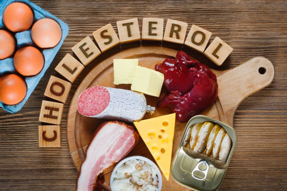 Cholesterol